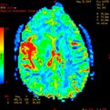 Thumbnail for Can Neuroscience Aid our Criminal Justice System?