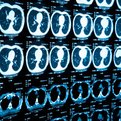 Thumbnail for Telling the Story of the Brain’s Cacophony of Competing Voices