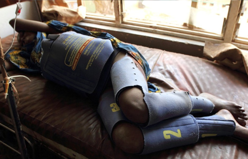 Population slideshow- anti-shock garment