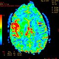 Can Neuroscience Aid our Criminal Justice System? thumbnail