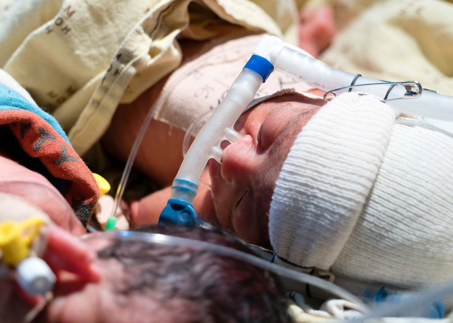 A newborn baby with a white hat in the hospital.
