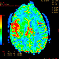 Neuroscience & the Law